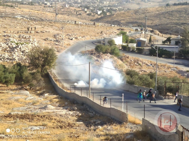 Injuries during clashes with the occupation in Tuqu'