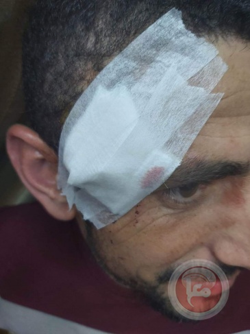 Civilians were injured and bruised in an attack by settlers west of Salfit