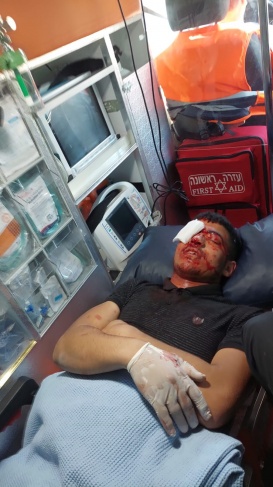 Injuries by "rubber"  And suffocation during clashes in Qarawat Bani Hassan