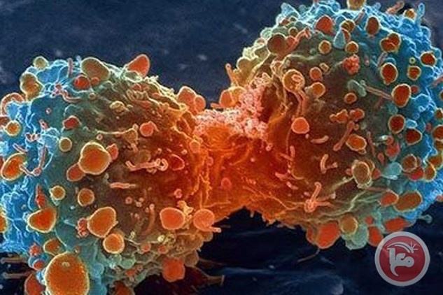 اربع مهن تحفز الأورام السرطانية